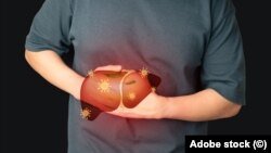 Hepatita este o inflamație a ficatului, cel mai frecvent cauzată de o infecție virală. (imagine simbol)